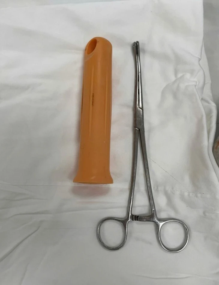 Thanh niên nhét cán cây lau nhà vào hậu môn, trôi sâu đến trực tràng - Ảnh 1.